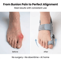 Thumbnail for Avenelle™ Realign Pro+ Foot Corrector – Restore Natural Toe Alignment